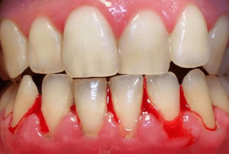 Hỏi đáp sức khỏe răng miệng về stress và các vấn đề liên quan